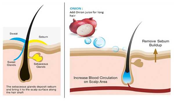 Benefits of onion juice