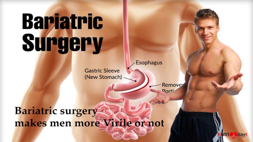 Bariatric surgery