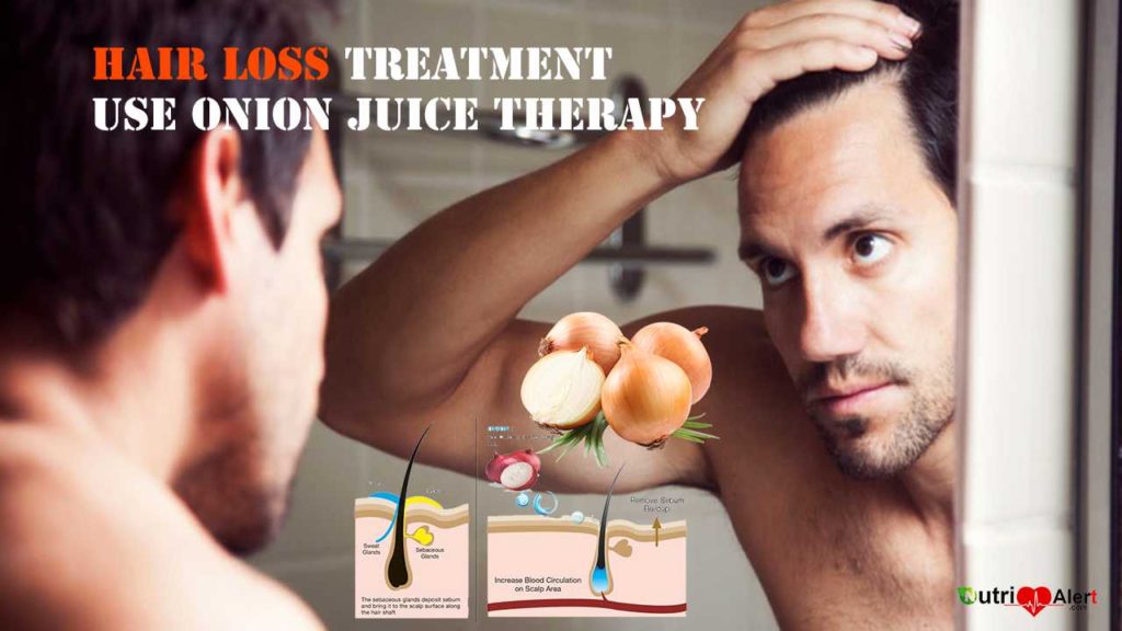 Benefits of onion juice for hair loss Treatment