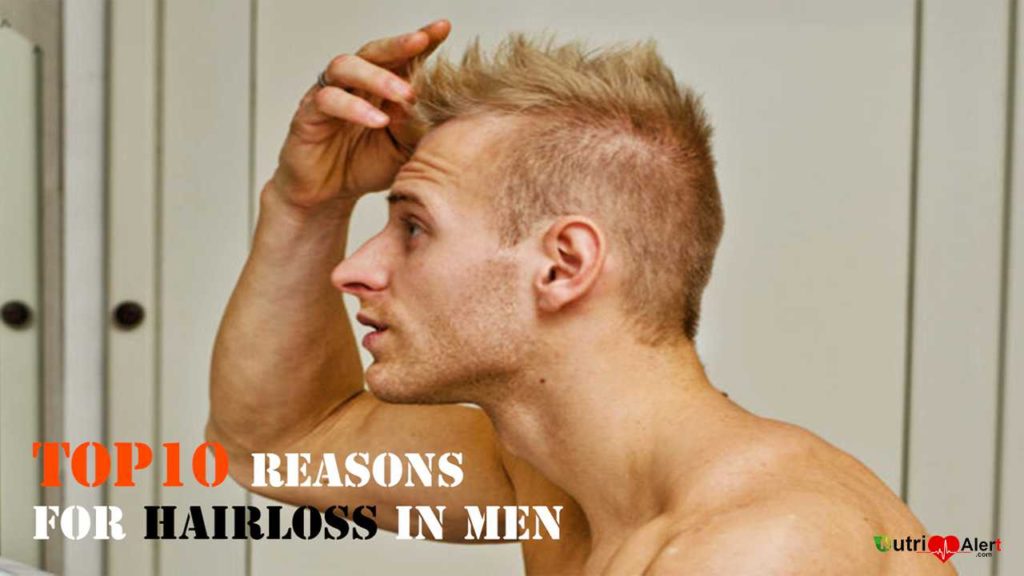 Reasons for Hair loss in men