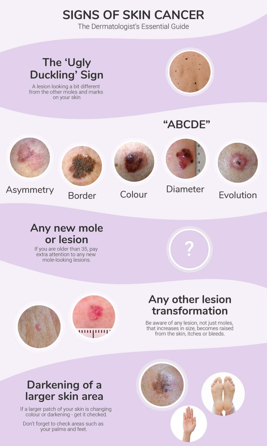 Comprehensive Guide To Identifying Skin Cancer Warning Signs Stay